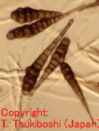 チョウセンニンジン斑点病菌