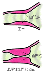 hps schema