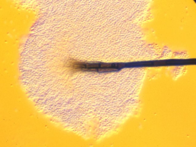 分生子世代の一つLeptographium属菌の分生子柄と分生子