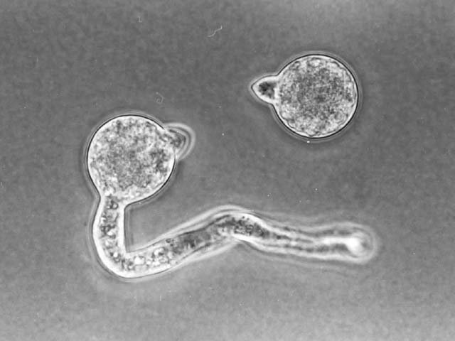 写真はConidiobolus colonatusの射出直後の胞子と発芽中の胞子
